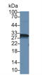 Carbonic Anhydrase 1 antibody, MBS2005478, MyBioSource, Western Blot image 