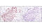 Histone Cluster 1 H2B Family Member B antibody, 2574S, Cell Signaling Technology, Immunohistochemistry paraffin image 