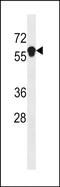 Ankyrin Repeat And Death Domain Containing 1B antibody, PA5-49080, Invitrogen Antibodies, Western Blot image 