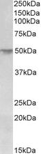 E2F Transcription Factor 3 antibody, 43-404, ProSci, Enzyme Linked Immunosorbent Assay image 