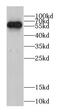 Chaperonin Containing TCP1 Subunit 5 antibody, FNab01400, FineTest, Western Blot image 