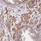 Larp antibody, NBP2-49004, Novus Biologicals, Immunohistochemistry frozen image 