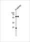 6-Phosphofructo-2-Kinase/Fructose-2,6-Biphosphatase 3 antibody, MBS9208152, MyBioSource, Western Blot image 