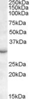 RAB23, Member RAS Oncogene Family antibody, EB08315, Everest Biotech, Western Blot image 