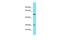 Transmembrane Protein 199 antibody, PA5-46336, Invitrogen Antibodies, Western Blot image 