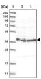 HemK Methyltransferase Family Member 1 antibody, PA5-57023, Invitrogen Antibodies, Western Blot image 