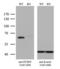 Proprotein Convertase Subtilisin/Kexin Type 9 antibody, LS-C796132, Lifespan Biosciences, Western Blot image 