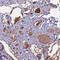Angiopoietin Like 2 antibody, NBP1-88998, Novus Biologicals, Immunohistochemistry frozen image 