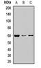 NOP58 Ribonucleoprotein antibody, LS-C668752, Lifespan Biosciences, Western Blot image 