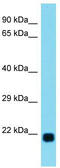 Ladybird Homeobox 2 antibody, TA342274, Origene, Western Blot image 