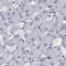 NHP2 Ribonucleoprotein antibody, NBP2-38626, Novus Biologicals, Immunohistochemistry paraffin image 