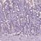 SLAM family member 5 antibody, NBP2-49635, Novus Biologicals, Immunohistochemistry frozen image 