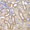 Matrix Metallopeptidase 14 antibody, LS-C332157, Lifespan Biosciences, Immunohistochemistry paraffin image 
