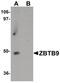 Zinc Finger And BTB Domain Containing 9 antibody, PA5-21095, Invitrogen Antibodies, Western Blot image 