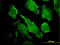Phospholipase C Gamma 1 antibody, LS-C197919, Lifespan Biosciences, Immunofluorescence image 
