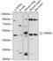 Corticotropin Releasing Hormone Receptor 2 antibody, 14-416, ProSci, Western Blot image 