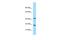 Crystallin Gamma N antibody, A17134, Boster Biological Technology, Western Blot image 