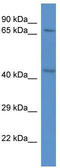 RAD21 Cohesin Complex Component antibody, TA345136, Origene, Western Blot image 