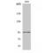 DNA Methyltransferase 3 Beta antibody, LS-C383179, Lifespan Biosciences, Western Blot image 