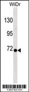 Ribophorin I antibody, 58-863, ProSci, Western Blot image 