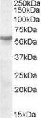 Cholinergic Receptor Nicotinic Beta 1 Subunit antibody, GTX88771, GeneTex, Western Blot image 