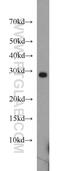 Phospholipid Phosphatase 7 (Inactive) antibody, 20635-1-AP, Proteintech Group, Western Blot image 
