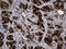 Ribonucleotide Reductase Regulatory Subunit M2 antibody, LS-C799703, Lifespan Biosciences, Immunohistochemistry paraffin image 