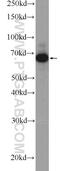 Plastin 3 antibody, 12917-1-AP, Proteintech Group, Western Blot image 