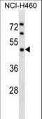 Kaptin, Actin Binding Protein antibody, LS-C165604, Lifespan Biosciences, Western Blot image 