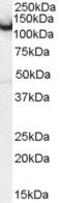 Amphiphysin antibody, PA5-18513, Invitrogen Antibodies, Western Blot image 