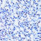 Chromobox 8 antibody, A05234, Boster Biological Technology, Immunohistochemistry paraffin image 
