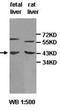 ADAM Metallopeptidase Domain 10 antibody, orb76982, Biorbyt, Western Blot image 