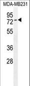 TCDD Inducible Poly(ADP-Ribose) Polymerase antibody, LS-C161896, Lifespan Biosciences, Western Blot image 