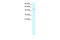Peroxisome Proliferator Activated Receptor Alpha antibody, 28-003, ProSci, Enzyme Linked Immunosorbent Assay image 