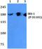 Insulin Receptor Substrate 1 antibody, A00268S1101, Boster Biological Technology, Western Blot image 