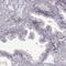 Hyaluronan mediated motility receptor antibody, HPA040025, Atlas Antibodies, Immunohistochemistry paraffin image 