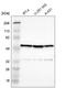 BBOF1 antibody, NBP1-91199, Novus Biologicals, Western Blot image 