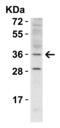 Rhomboid Domain Containing 1 antibody, 5525, ProSci, Western Blot image 