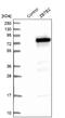 Zinc Finger And BTB Domain Containing 2 antibody, NBP1-88789, Novus Biologicals, Western Blot image 