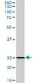 Triggering Receptor Expressed On Myeloid Cells 1 antibody, H00054210-D01P, Novus Biologicals, Western Blot image 