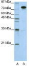 Splicing Factor Proline And Glutamine Rich antibody, TA345907, Origene, Western Blot image 