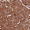 Component Of Oligomeric Golgi Complex 4 antibody, NBP2-48766, Novus Biologicals, Immunohistochemistry paraffin image 