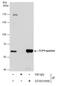 Chaperonin Containing TCP1 Subunit 5 antibody, GTX631668, GeneTex, Immunoprecipitation image 