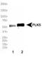 Polo Like Kinase 5 antibody, NBP1-97306, Novus Biologicals, Western Blot image 