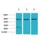 AKT Serine/Threonine Kinase 2 antibody, LS-C387860, Lifespan Biosciences, Western Blot image 