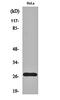 Interferon Alpha Inducible Protein 27 antibody, orb159664, Biorbyt, Western Blot image 