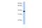 Ankyrin Repeat And SOCS Box Containing 5 antibody, A16204, Boster Biological Technology, Western Blot image 