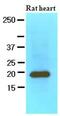 Myosin Light Chain 2 antibody, MBS200152, MyBioSource, Western Blot image 