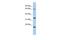 Tumor Protein P63 Regulated 1 antibody, GTX45170, GeneTex, Western Blot image 