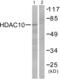 Histone Deacetylase 10 antibody, abx013104, Abbexa, Western Blot image 